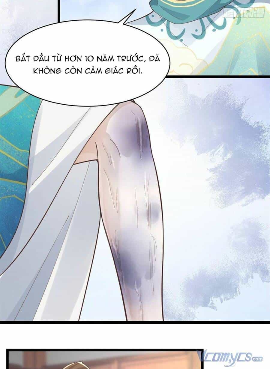 Bệnh Kiều Vương Gia Dựa Vào Ta Để Tiếp Tục Sống - Chương 33 - ảnh 5
