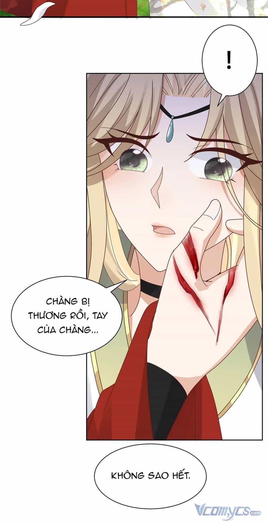 Bệnh Kiều Vương Gia Dựa Vào Ta Để Tiếp Tục Sống - Chương 93 - ảnh 17