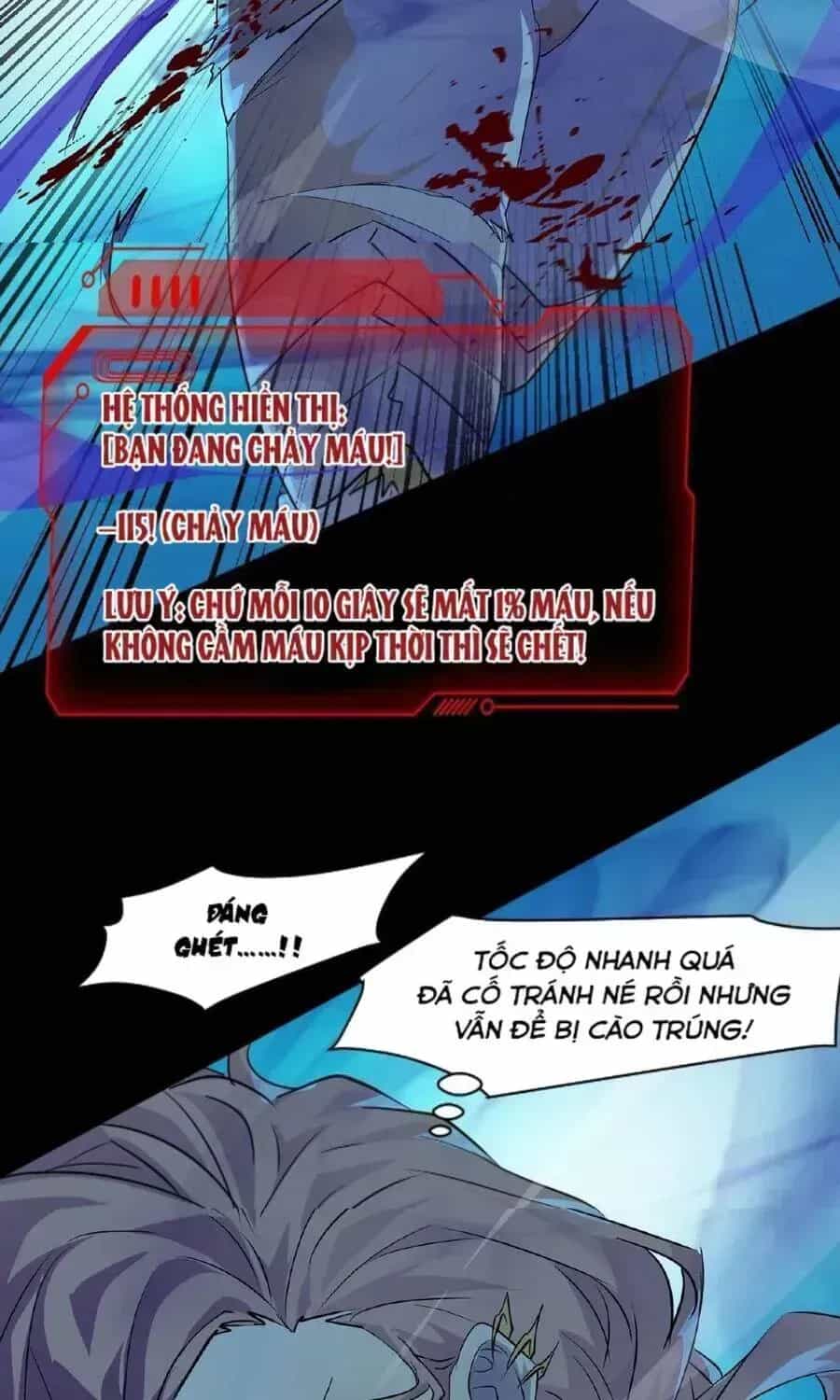 Chỉ Có Ta Có Thể Sử Dụng Triệu Hoán Thuật - Chương 5.4 - ảnh 22