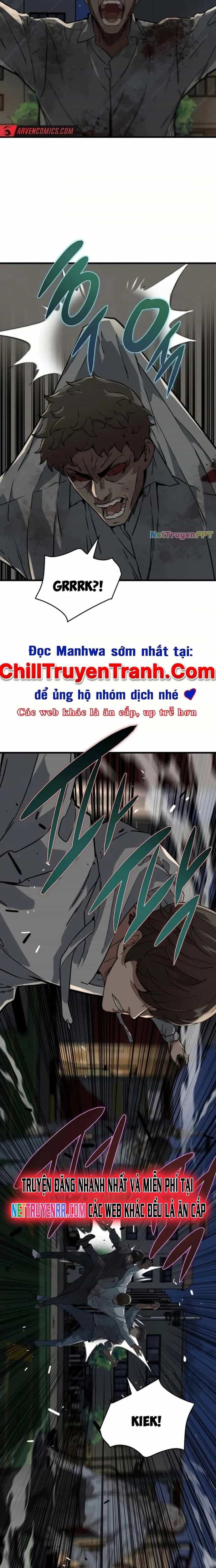 Chỉ Có Ta Không Bị Zombie Tấn Công - Chương 7 - ảnh 2