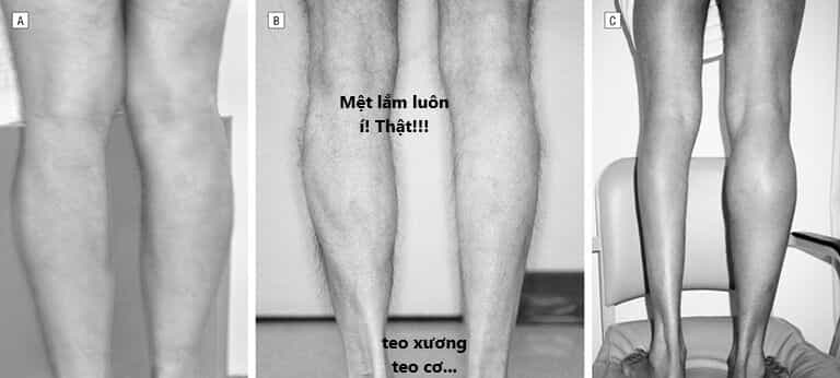 Ngay Cả Khi Hậu Tận Thế, Thật Hạnh Phúc Khi Vẫn Còn Được Sống... (Puchimasu Miếu) - Chương 42.2 - ảnh 14